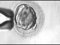 Egg Freezing | Fertility Preservation