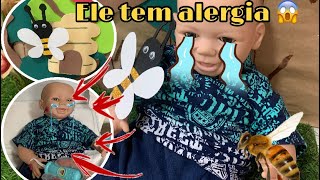 Baby Miguel Foi Picado Por Abelhas -Fomos Para O Hospital Milli Produções