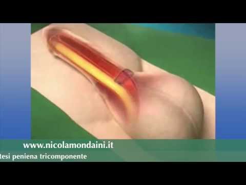 Aumento di un gel di pene