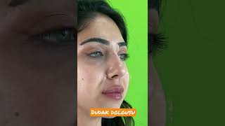 Dudak Dolgusu