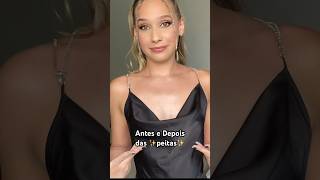 Antes E Depois Silicone