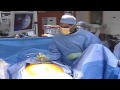 InterStim Therapy for Bladder Control Problems