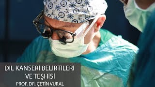 Dil Kanseri Belirtileri ve Teşhisi - Prof. Dr. Çetin Vural
