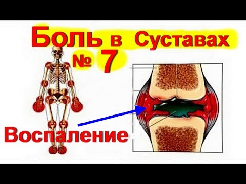 Болят суставы на ногах лечение в домашних условиях Болят суставы на ногах лечение в домашних