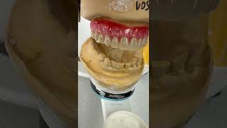 For Strong Denture