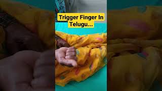 Trigger Finger In Telugu...dr Sai Chandra Mbbs Dnb Ortho