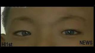 'Cat Eye'   Boy   Kid    with   Night   Vision   Eyes   -- News Story