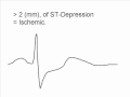 The ST Elevation Song!  (What to Look for on an EKG)