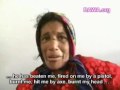 Afghan woman Fatima was abused and injured by her husband