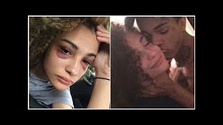 Me Peó Y Estranguló El Brutal Relato De La Exnovia De Xtentacion