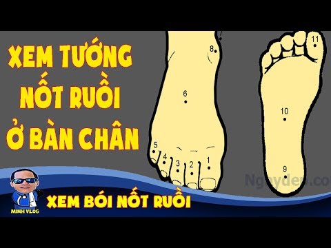 Xem tướng nốt ruồi ở bàn chân nam giới và nữ giới | Xem Bói Nốt Ruồi