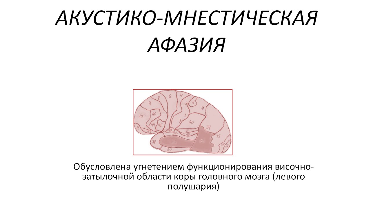 Схемы и таблицы по афазии Схемы и таблицы по афазии