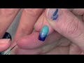 Nail