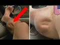 Muscle cramps explained: What’s causing this guy’s leg to spasm horrifically? - TomoNews