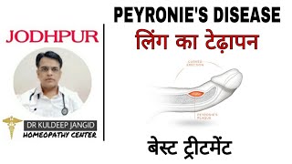 लग म टढपन क परमनट टरटमट Best Treatment Of Peyronies Disease