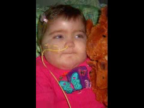 Right! Idea Tay sachs disease in adult Amusing Tay sachs disease in adult