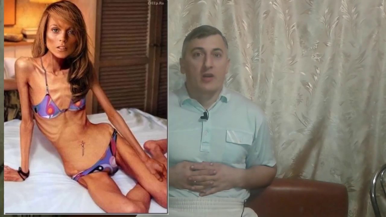 как дойти до анорексии за месяц