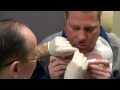 Removing gauze packing post sinus surgery - 2