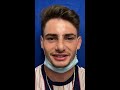 Septorhinoplasty/Sinus Surgery 3 weeks ago-doing well