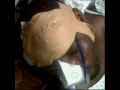 oscar bartholomew brutally beaten by police in grenada 2011