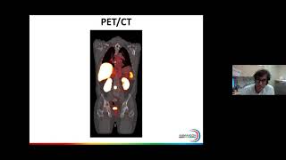 22-01. Drs. Auerbach & Calais "Theranostics: Imaging and Treatment of Prostate Cancer" 2022-01-27