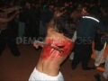 Matam