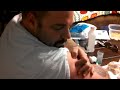 Nastiest Pimple Pop Ever images Nastiest Pimple Pop Ever