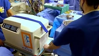 Historic Heart Transplant Using A Heart That Stopped Beating Conducted In Canada