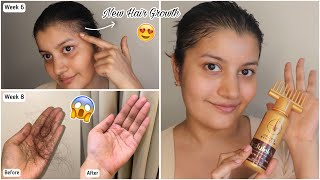 My 2 Months Journey Of Using Indulekha Hair Oil