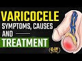 Varicocele -Symptoms, Causes and Treatment | Varicocele Natural Treatment | Testis Pain Relief