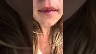 Kisses