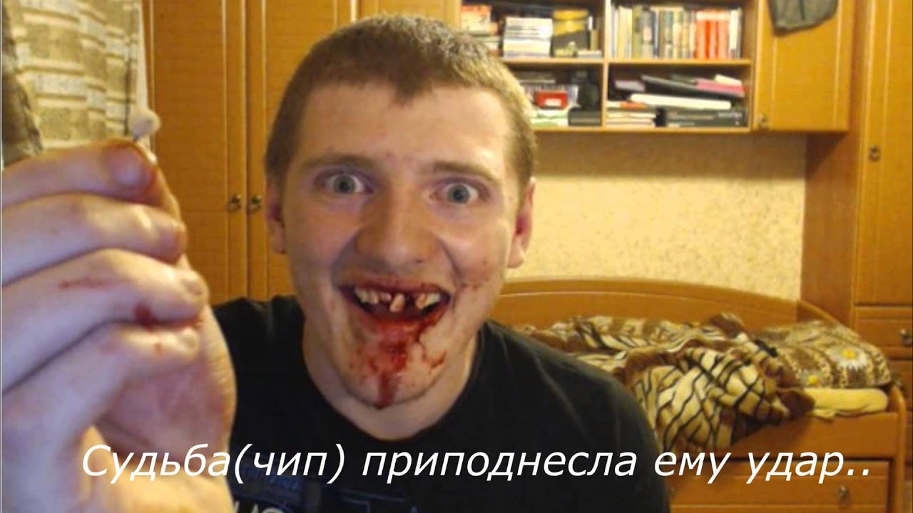 Выбитые зубы на стриме Выбитые зубы на стриме