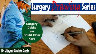 लग सध करन क सरजर टढ लग क सध कस कर