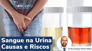 Sangue na urina? Tipos, Causas e o risco de câncer. Uro-oncologista explica