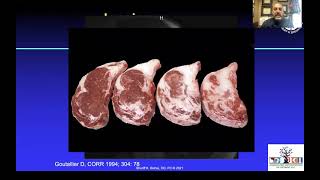 Treatment of Medium to Large Rotator Cuff Tears