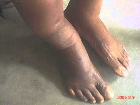 trina nake amateur nude thread