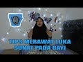 TIPS MERAWAT LUKA SUNAT PADA BAYI SUPAYA CEPAT KERING