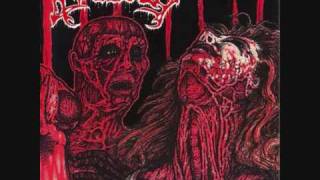 Watch Avulsed Carnivoracity video