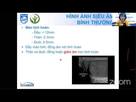 Cập nhật mới nhất về siêu âm giãn tĩnh mạch tinh