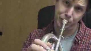 Watch Braces 8 video