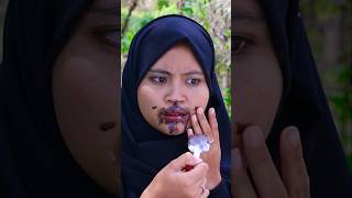 Belepotan