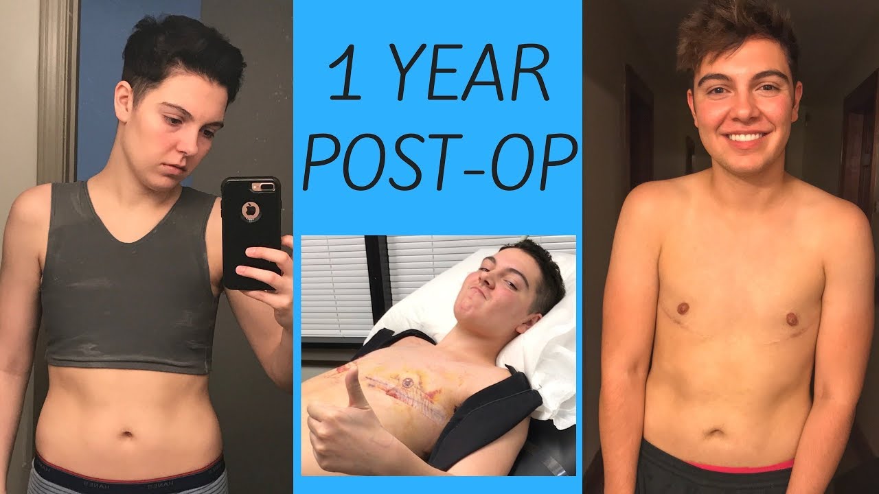 Ftm post metoidioplasty fucks his