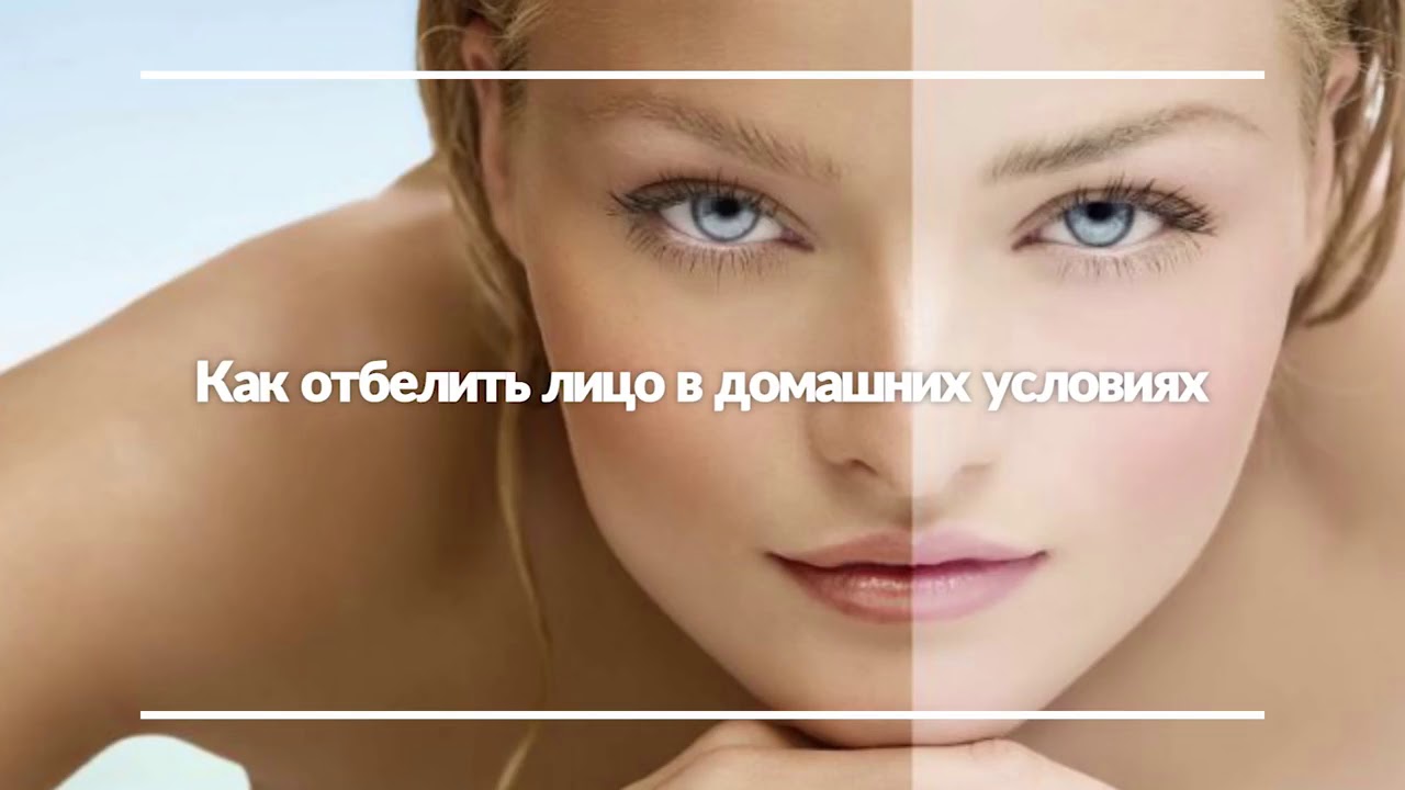 Как отбелить лицо в домашних условиях быстро перекисью Как отбелить лицо в домашних условиях быстро перекисью