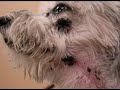 Abscessed Teeth