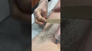 Underarm Wax Demonstration Part 1 - Hair Removal