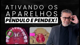Diferença Entre Pêndulo E Pendex Guia De Ativação