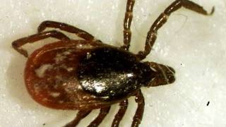 New Infectious Disease From Ticks