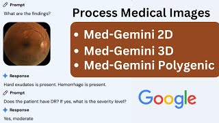 Google Releases Med Gemini Polygenic 2D And 3D To Process Medical Images