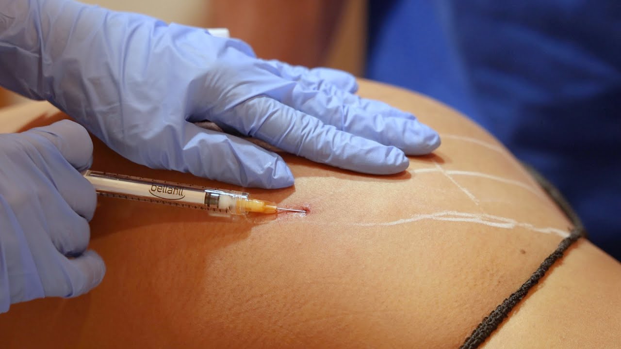 Im injection butt ass shot needle