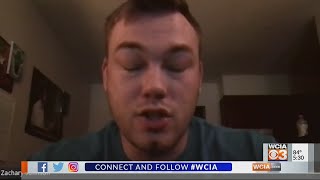 Amber Johnson Wakes Up From Coma